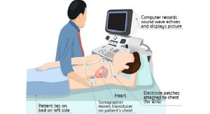 آشنایی با اکوکاردیوگرافی