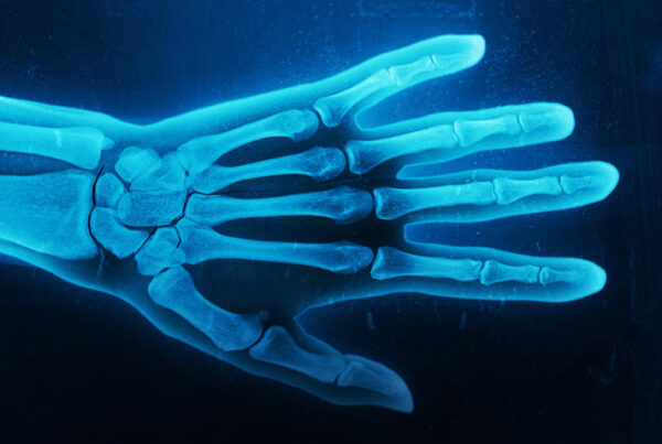 طراحی تصویر رادیولوژی با فتوشاپ