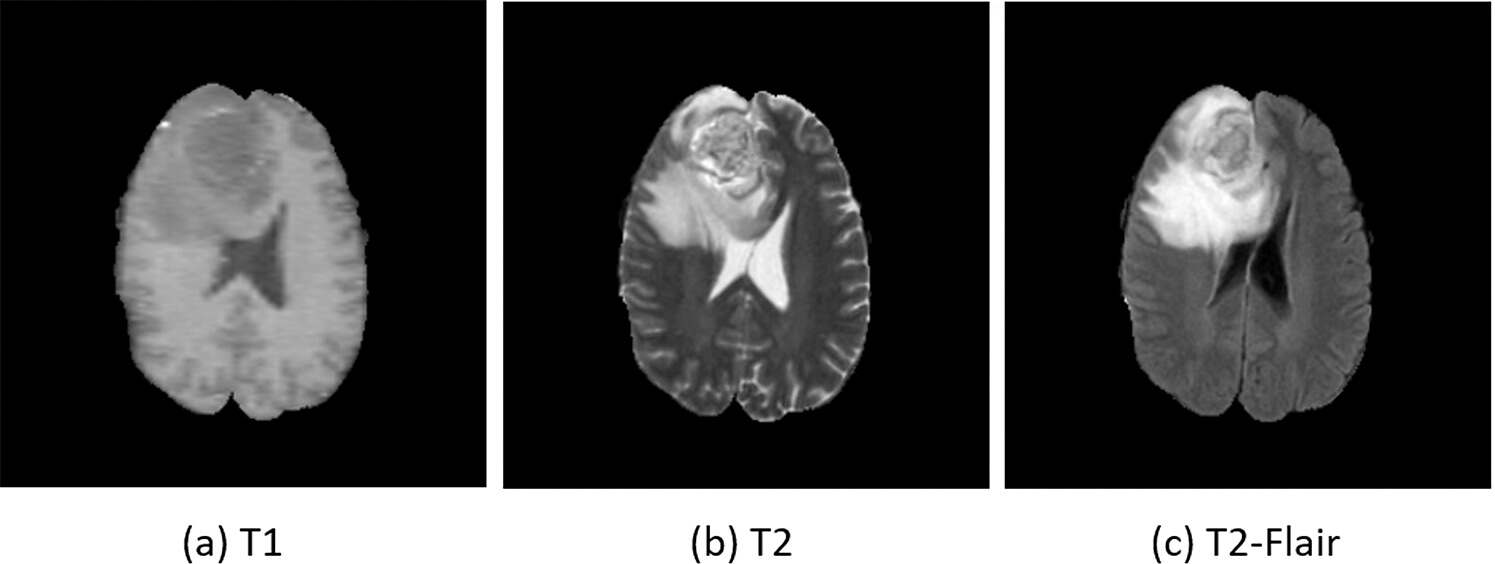چگونگی تبدیل سی دی MRI به عکس