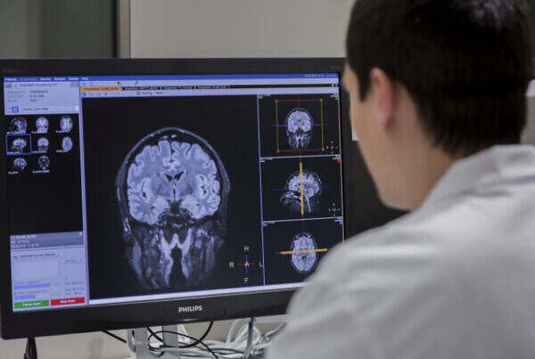 بیماری آلزایمر با MRI