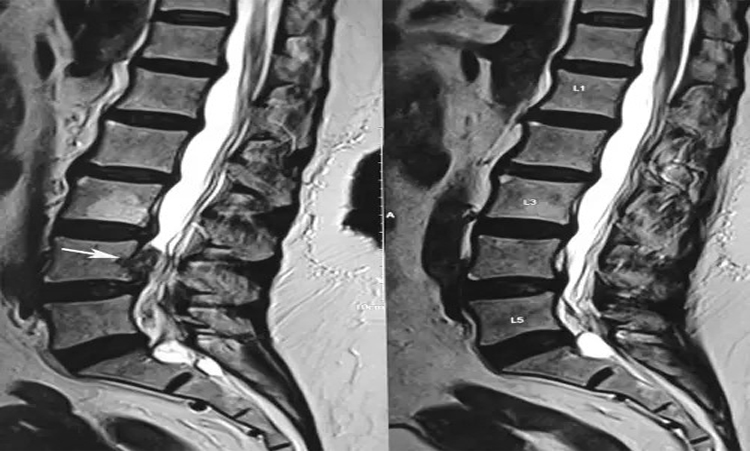 آمادهسازی بیمار برای ام آر آی