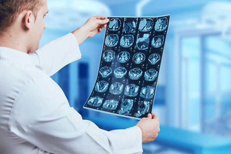راهنمای کامل چاپ تصاویر پزشکی MRI و CT Scan در سال 2026