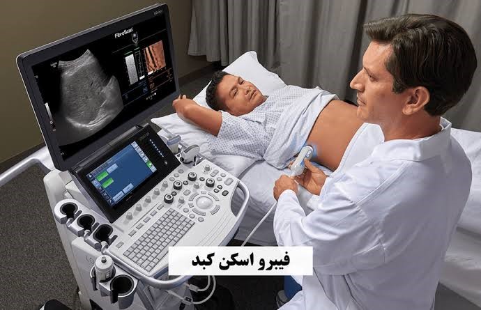 فیبرواسکن کبد